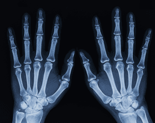 Bàn tay nói gì về sức khỏe, từ viêm khớp đến tiểu đường – những dấu hiệu nhận biết